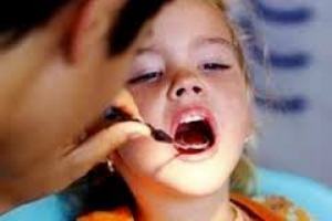 сріблення зубів дитини