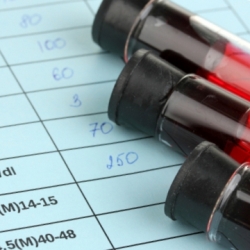 Біохімічний аналіз крові дитини: сечова кислота – норма, підвищення та пониження