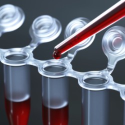 Біохімічний аналіз крові дитини (ферменти): АЛТ (аланінамінотрансфераза)
