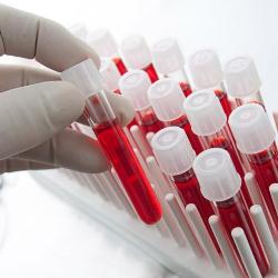 Біохімічний аналіз крові дитини (ферменти): АСТ (АсАТ)